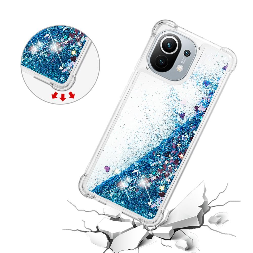 Xiaomi Mi 11 Glitter Powder TPU Case Blauw